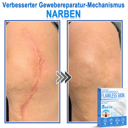 👩‍⚕️ Celsiora® 2-in-1 Mikronadel- & Hydrokolloid-Pflaster | Entferner für erhabene Muttermale, Akne, flache Warzen & Hautanhängsel | Verbessert Falten, Narben & Hautunreinheiten | Unsichtbare Stern-Pickelpflaster für Gesicht & Körper