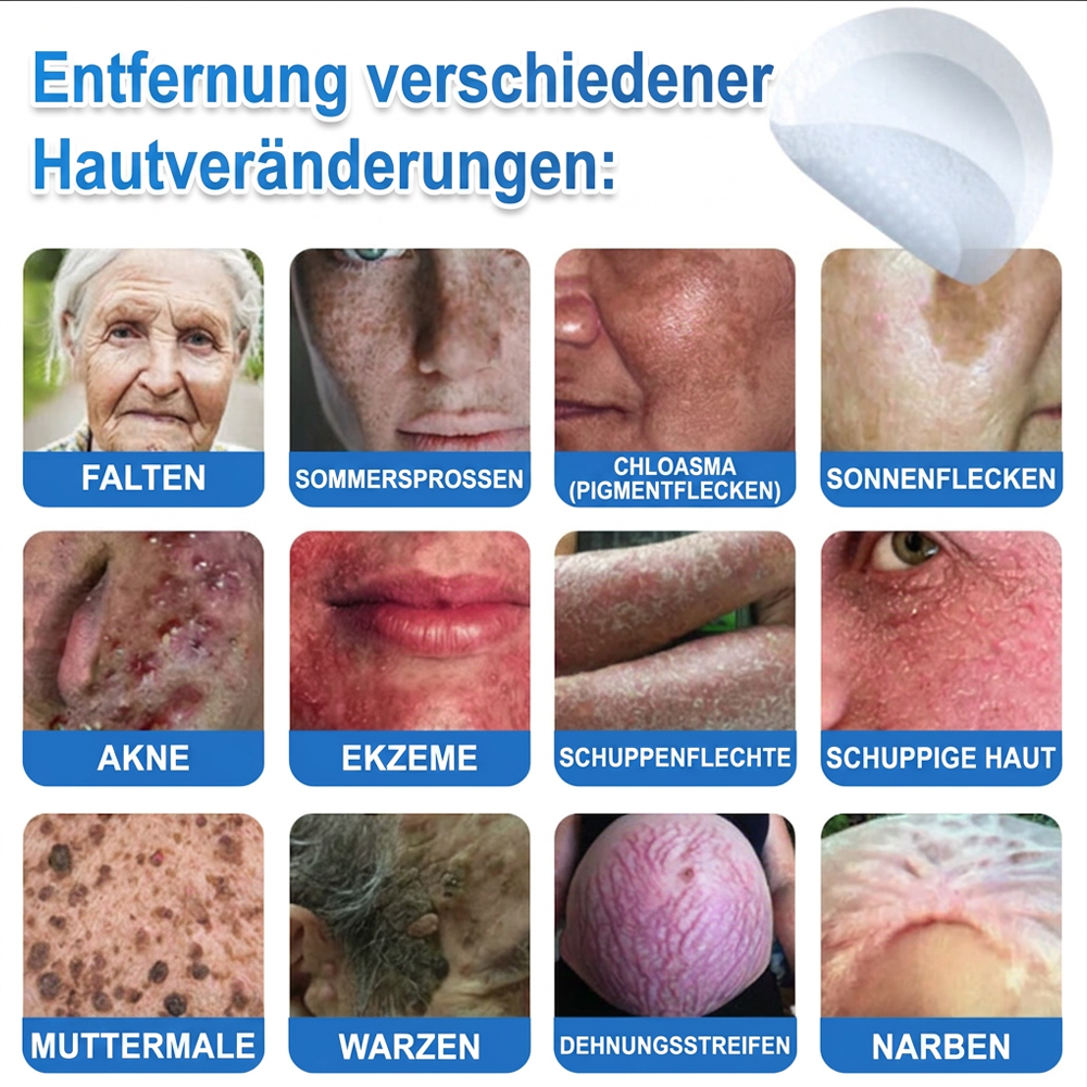 👩‍⚕️ Celsiora® 2-in-1 Mikronadel- & Hydrokolloid-Pflaster | Entferner für erhabene Muttermale, Akne, flache Warzen & Hautanhängsel | Verbessert Falten, Narben & Hautunreinheiten | Unsichtbare Stern-Pickelpflaster für Gesicht & Körper