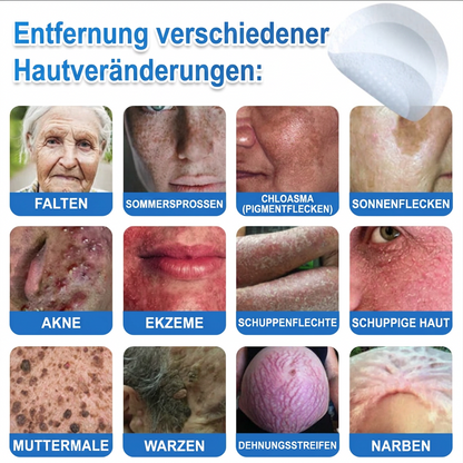 👩‍⚕️ Celsiora® 2-in-1 Mikronadel- & Hydrokolloid-Pflaster | Entferner für erhabene Muttermale, Akne, flache Warzen & Hautanhängsel | Verbessert Falten, Narben & Hautunreinheiten | Unsichtbare Stern-Pickelpflaster für Gesicht & Körper