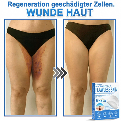 👩‍⚕️ Celsiora® 2-in-1 Mikronadel- & Hydrokolloid-Pflaster | Entferner für erhabene Muttermale, Akne, flache Warzen & Hautanhängsel | Verbessert Falten, Narben & Hautunreinheiten | Unsichtbare Stern-Pickelpflaster für Gesicht & Körper