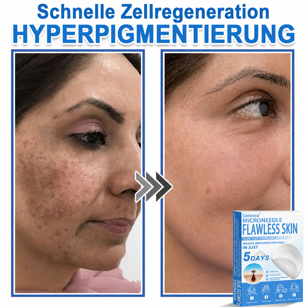 👩‍⚕️ Celsiora® 2-in-1 Mikronadel- & Hydrokolloid-Pflaster | Entferner für erhabene Muttermale, Akne, flache Warzen & Hautanhängsel | Verbessert Falten, Narben & Hautunreinheiten | Unsichtbare Stern-Pickelpflaster für Gesicht & Körper