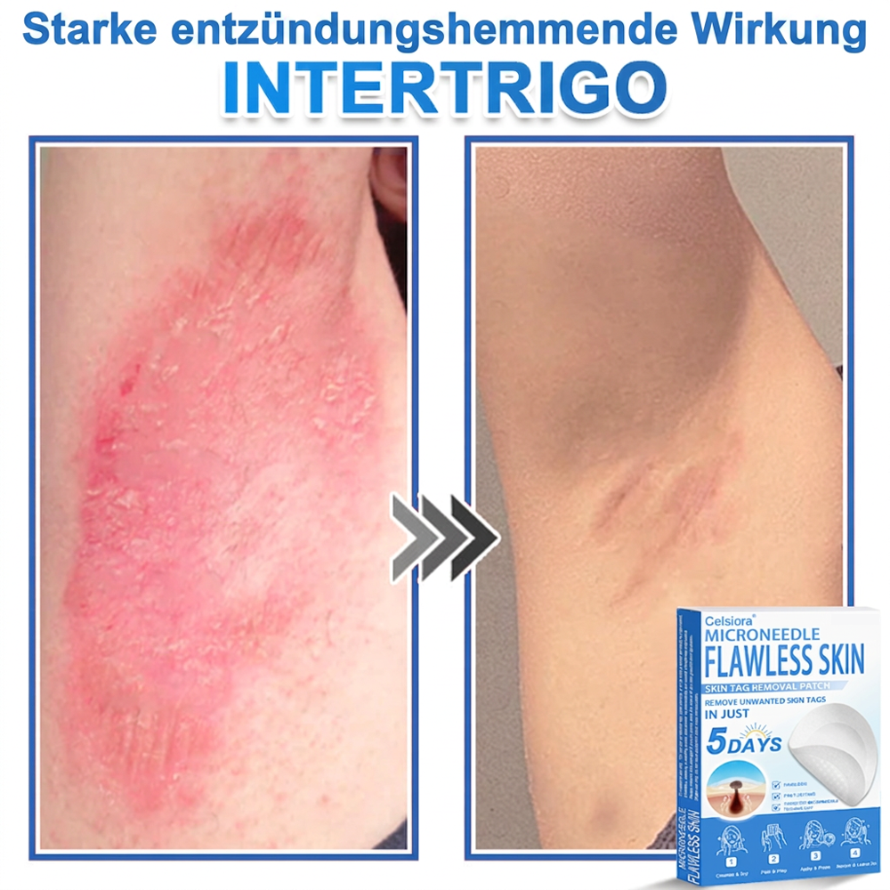 👩‍⚕️ Celsiora® 2-in-1 Mikronadel- & Hydrokolloid-Pflaster | Entferner für erhabene Muttermale, Akne, flache Warzen & Hautanhängsel | Verbessert Falten, Narben & Hautunreinheiten | Unsichtbare Stern-Pickelpflaster für Gesicht & Körper