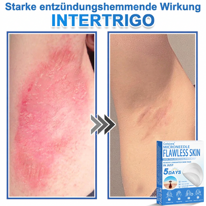 👩‍⚕️ Celsiora® 2-in-1 Mikronadel- & Hydrokolloid-Pflaster | Entferner für erhabene Muttermale, Akne, flache Warzen & Hautanhängsel | Verbessert Falten, Narben & Hautunreinheiten | Unsichtbare Stern-Pickelpflaster für Gesicht & Körper