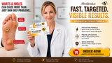 Simple Daily Care for Warts, Moles and Rough Skin Areas